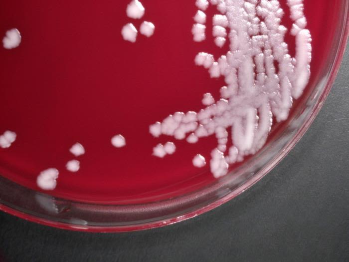 Anthrax bacterial culture in a petri dish. 
